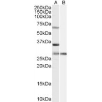 Western blot analysis of PRPF31 in HeLa Lysate (35 μg protein in RIPA buffer) with (B) and without (A) blocking with the immunizing peptide using PRPF31 antibody (1 μg/mL).