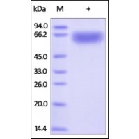 The purity of rh CNDP1 was determined by DTT-reduced (+) SDS-PAGE and staining overnight with Coomassie Blue.