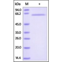 The purity of rh TNFRSF6B / DcR3 Fc Chimera was determined by DTT-reduced (+) SDS-PAGE and staining overnight with Coomassie Blue.