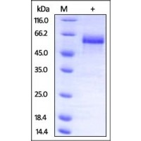Mouse Dkk-3, His Tag on SDS-PAGE under reducing (R) condition. The gel was stained overnight with Coomassie Blue. The purity of the protein is greater than 95%.