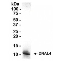 SDS PAGE: Analysis of DNAL4 Recombinant Protein. 4-20% SDS gradient gel. Coomassie blue staining.