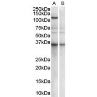 Western blot analysis of PUM2 in human Epstein-Barr virus Immortalized lymphoblastoid Lysate (35 μg protein in RIPA buffer) with (B) and without (A) blocking with the immunizing peptide using PUM2 antibody (1 μg/mL).