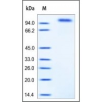 The purity of mouse EGFR was determined by DTT-reduced (+) SDS-PAGE and staining overnight with Coomassie Blue.