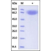 The purity of rh EPHA7 was determined by DTT-reduced (+) SDS-PAGE and staining overnight with Coomassie Blue.