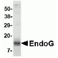 SDS-PAGE analysis of recombinant EndoG fragment on Coomassie Blue-stained 4-20% gradient gel.