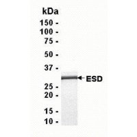 SDS PAGE: Analysis of ESD Recombinant Protein. 4-20% SDS gradient gel. Coomassie blue staining.
