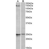 Western blot analysis of RBM20 in Mouse Heart Lysate (35 μg protein in RIPA buffer) with (B) and without (A) blocking with the immunizing peptide.RBM20 antibody (1 μg/mL).
