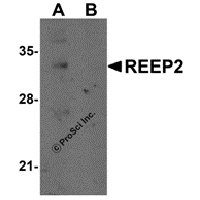 Western blot analysis of REEP2 in mouse lung tissue lysate with REEP2 antibody at 1 μg/mL in (A) the absence and (B) the presence of blocking peptide.