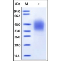 The purity of rh CD16b was determined by DTT-reduced (+) SDS-PAGE and staining overnight with Coomassie Blue.