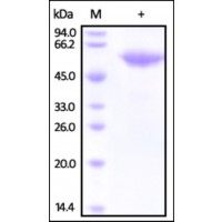 The purity of rh FETUB / Fetuin-B was determined by DTT-reduced (+) SDS-PAGE and staining overnight with Coomassie Blue.