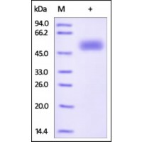 The purity of rh FZD5 / Frizzled-5 Fc Chimera was determined by DTT-reduced (+) SDS-PAGE and staining overnight with Coomassie Blue.