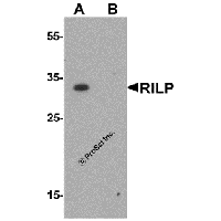 Western blot analysis of RILP in HeLa cell lysate with RILP antibody at 1 μg/mL in (A) the absence and (B) the presence of blocking peptide.