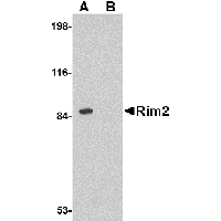 Western blot analysis of Rim2 in rat brain tissue lysate with Rim2 antibody at 1 μg/mL in the (A) absence or (B) presence of blocking peptide.