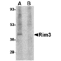 Western blot analysis of Rim3 in human brain tissue lysate with Rim3 antibody at 1 μg/mL in the (A) absence and (B) presence of blocking peptide.