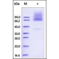 The purity of rh GPC3 / Glypican-3 was determined by DTT-reduced (+) SDS-PAGE and staining overnight with Coomassie Blue.