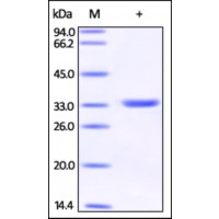 The purity of rh GPD1 /GPDH was determined by DTT-reduced (+) SDS-PAGE and staining overnight with Coomassie Blue.