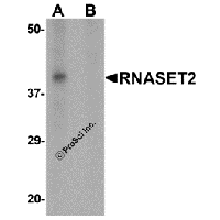 Western blot analysis of RNASET2 in SW480 cell lysate with RNASET2 antibody at 1 μg/mL in (A) the absence and (B) the presence of blocking peptide.