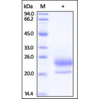 The purity of rh NPC2 / HE1 was determined by DTT-reduced (+) SDS-PAGE and staining overnight with Coomassie Blue.