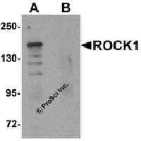Western blot analysis of ROCK1 in 293 cell lysate with ROCK1 antibody at 1 μg/mL in (A) the absence and (B) the presence of blocking peptide.