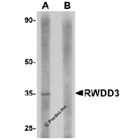 Western blot analysis of RWDD3 in rat kidney tissue lysate with RWDD3 antibody at 1 μg/mL in (A) the absence and (B) the presence of blocking peptide.