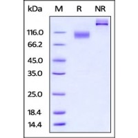 Mouse IL-23 R, Fc Tag on SDS-PAGE under reducing (R) and no-reducing (NR) conditions. The gel was stained overnight with Coomassie Blue. The purity of the protein is greater than 95%.
