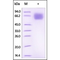 The purity of rh IL18BP /IL-18BPa Fc Chimera was determined by DTT-reduced (+) SDS-PAGE and staining overnight with Coomassie Blue.