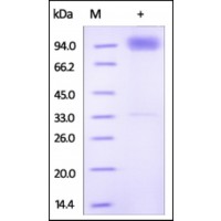 The purity of rh IL18R1 /CD218a Fc Chimera was determined by DTT-reduced (+) SDS-PAGE and staining overnight with Coomassie Blue.