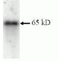 SDS Page pattern of purified IMP-3 recombinant protein was stained with Coomassie Blue.