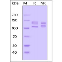 Human ITGA7X2B & ITGB1 Heterodimer Protein on SDS-PAGE under reducing (R) and no-reducing (NR) conditions. The gel was stained overnight with Coomassie Blue. The purity of the protein is greater than 90%.