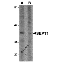 Western blot analysis of SEPT1 in Raji cell lysate with SEPT1 antibody at 1 μg/ml in (A) the absence and (B) the presence of blocking peptide.