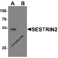 Western blot analysis of SESTRIN2 in mouse kidney tissue lysate with SESTRIN2 antibody at 1 μg/ml in (A) the absence and (B) the presence of blocking peptide.