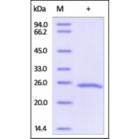 The purity of rh MAD2L1 /MAD2 was determined by DTT-reduced (+) SDS-PAGE and staining overnight with Coomassie Blue.