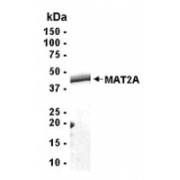 SDS PAGE: Analysis of MAT2A Recombinant Protein. 4-20% SDS gradient gel. Coomassie blue staining.