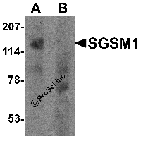 Western blot analysis of SGSM1 in human cerebellum tissue lysate with SGSM1 antibody at 1 μg/ml in (A) the absence and (B) the presence of blocking peptide.