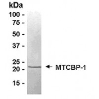 SDS PAGE: Analysis of MTCBP-1 Recombinant Protein. 4-20% SDS gradient gel. Coomassie blue staining.