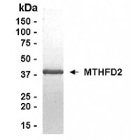 SDS PAGE: Analysis of MTHFD2 Recombinant Protein. 4-20% SDS gradient gel. Coomassie blue staining.
