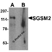 Western blot analysis of SGSM2 in human cerebellum tissue lysate with SGSM2 antibody at 1 μg/ml in (A) the absence and (B) the presence of blocking peptide