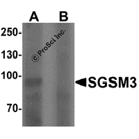 Western blot analysis of SGSM3 in 293 cell lysate with SGSM3 antibody at 1 μg/mL in (A) the absence and (B) the presence of blocking peptide.