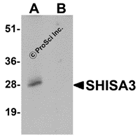 Western blot analysis of SHISA3 in human small intestine Tissue lysate with SHISA3 antibody at 1 μg/mL in (A) the absence and (B) the presence of blocking peptide.