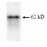 SDS Page pattern of purified p62 recombinant protein was stained with Coomassie Blue.