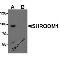 Western blot analysis of SHROOM1 in mouse heart tissue lysate with SHROOM1 antibody at 1 μg/mL in (A) the absence and (B) the presence of blocking peptide.