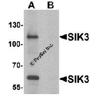 Western blot analysis of SIK3 in rat brain tissue lysate with SIK3 antibody at 1 μg/mL in (A) the absence and (B) the presence of blocking peptide.
