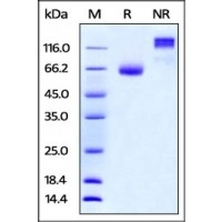 Mouse PD-L2 / B7-DC, Fc Tag on SDS-PAGE under reducing (R) and no-reducing (NR) conditions. The gel was stained overnight with Coomassie Blue. The purity of the protein is greater than 95%.