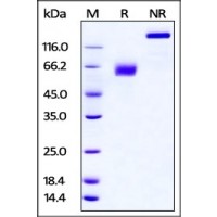 Mouse PD-L2, mouse IgG2a Fc Tag, low endotoxin on SDS-PAGE under reducing (R) and no-reducing (NR) conditions. The gel was stained overnight with Coomassie Blue. The purity of the protein is greater than 95%.