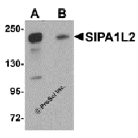 Western blot analysis of SIPA1L2 in rat brain tissue lysate with SIPA1L2 antibody at 1 μg/mL in (A) the absence and (B) the presence of blocking peptide.