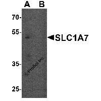 Western blot analysis of SLC1A7 in C2C12 cell lysate with SLC1A7 antibody at 1 μg/ml in (A) the absence and (B) the presence of blocking peptide.