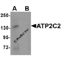 Western blot analysis of ATP2C2 in 3T3 cell lysate with ATP2C2 antibody at 1 μg/mL in (A) the absence and (B) the presence of blocking peptide.