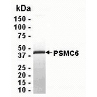 SDS PAGE: Analysis of PSMC6 Recombinant Protein. 4-20% SDS gradient gel. Coomassie blue staining.