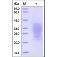 The purity of rh PTH1R / PTHR1 was determined by DTT-reduced (+) SDS-PAGE and staining overnight with Coomassie Blue.