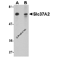 Western blot analysis of Slc37A2 in mouse spleen tissue lysate with Slc37A2 antibody at 1 μg/mL in the (A) absence and (B) presence of blocking peptide.